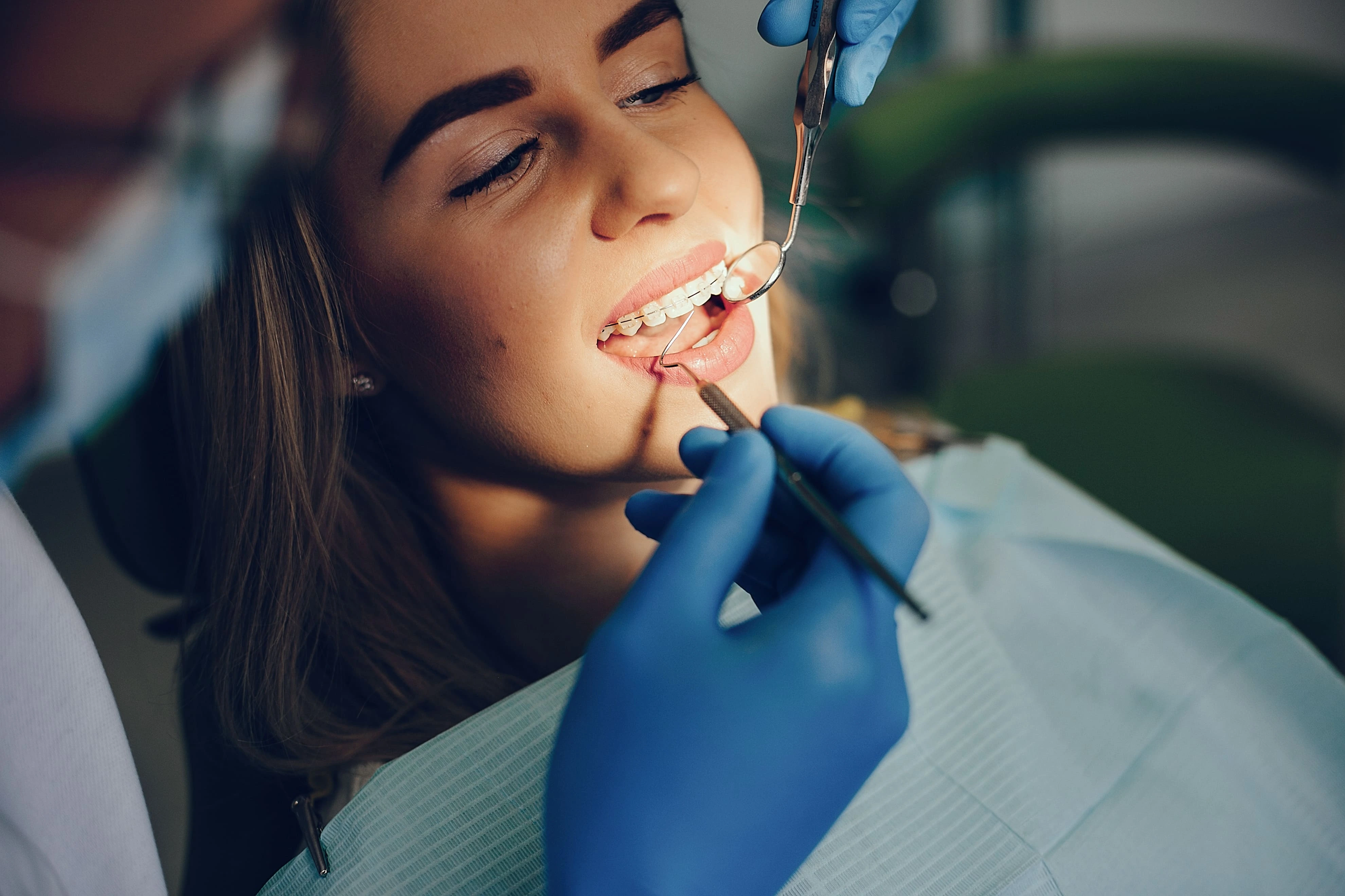Orthodontic treatment at Smiles in Motion